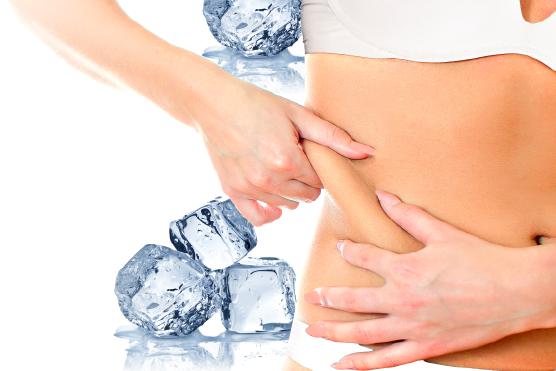 Coolsculpting for Fat Reduction